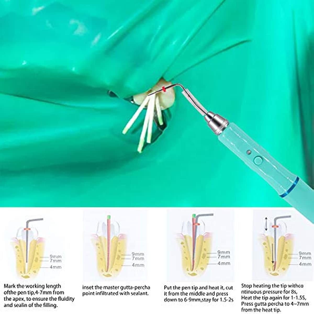 DENTASOP Refill System Gutta Percha Root Canal heated dissolving pen tooth glue tip cut refill