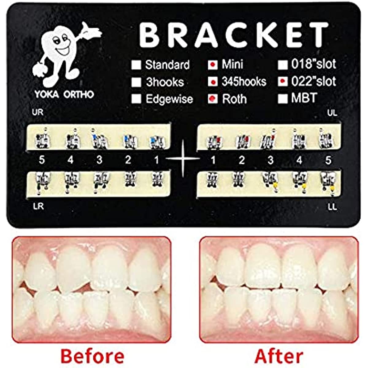 Brackets Monoblock Mini Roth .022 3-4-5 Hook - Sadec Dental
